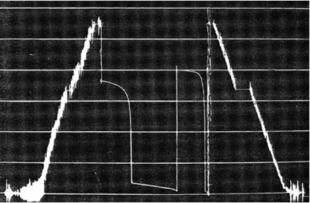 Fig. 4.15 Incorrect base line and shut off during flow (Ligne de base incorrecte et bouchage pendant d´ebit)