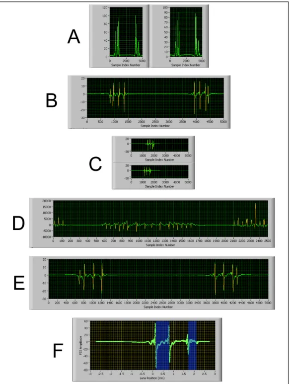 Fig. 10 - The signal processing system used for synthetic-aperture confocal pachymetry is shown graphically