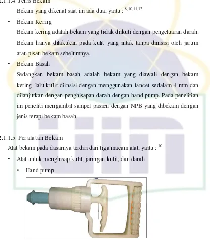 Gambar 2.1. Hand Pump (Asosiasi Bekam Indonesia - ABI)22