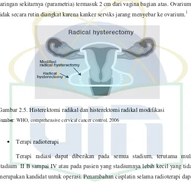 Gambar 2.5. Histerektomi radikal dan histerektomi radikal modifikasi 