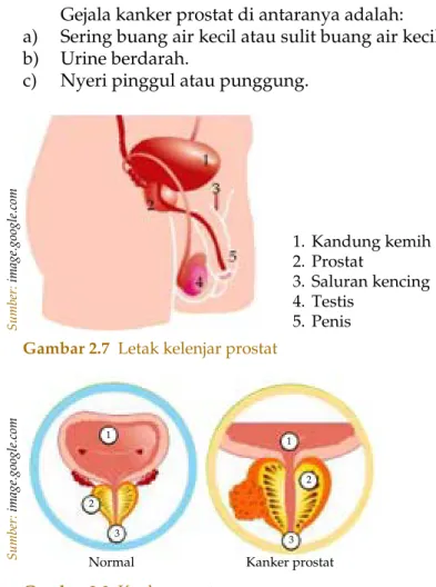 Gambar 2.7  Letak kelenjar prostat