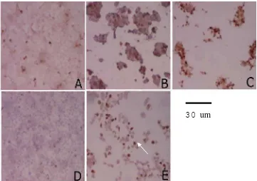 Gambar  1.  Imunohistokimia  sel  WiDr  dengan  antibodi  anti- caspase-3  aktif.  Sel  difiksasi  48  jam  setelah  perlakuan