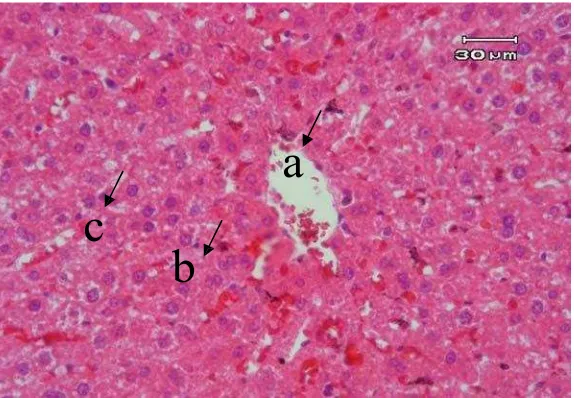 Gambar 3 .  Gambar mikroskopik hati tikus strain wistar jantan kelompok III dosis 0,54 ml (pewarnaan H&E pembesaran 40x)struktur dan susunan sel hati: a.vena sentralis normal dan c