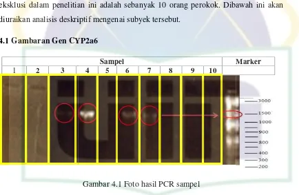 Gambar 4.1 Foto hasil PCR sampel