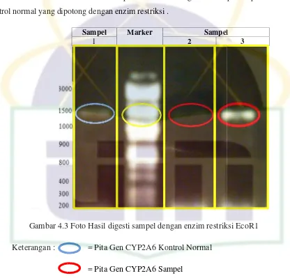 Gambar 4.3 4.3 Foto Hasil digesti sampel dengan enzim restriks