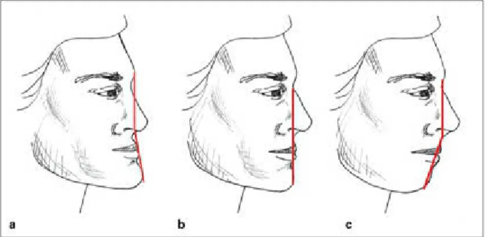 Fig 3-6 Profile types: (a) concave; (b) straight; (c) convex.