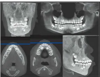 Fig 3-22 Different CT scans of a patient with oligodontia.