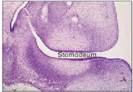Fig 2-1 Epithelial thickening.