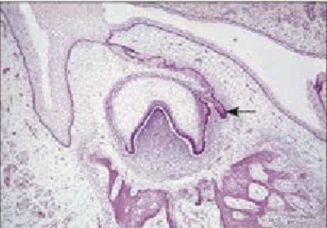Fig 2-6 Permanent tooth bud formation.