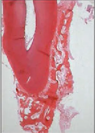 Fig 2-17 Formation of tooth-supporting tissue.