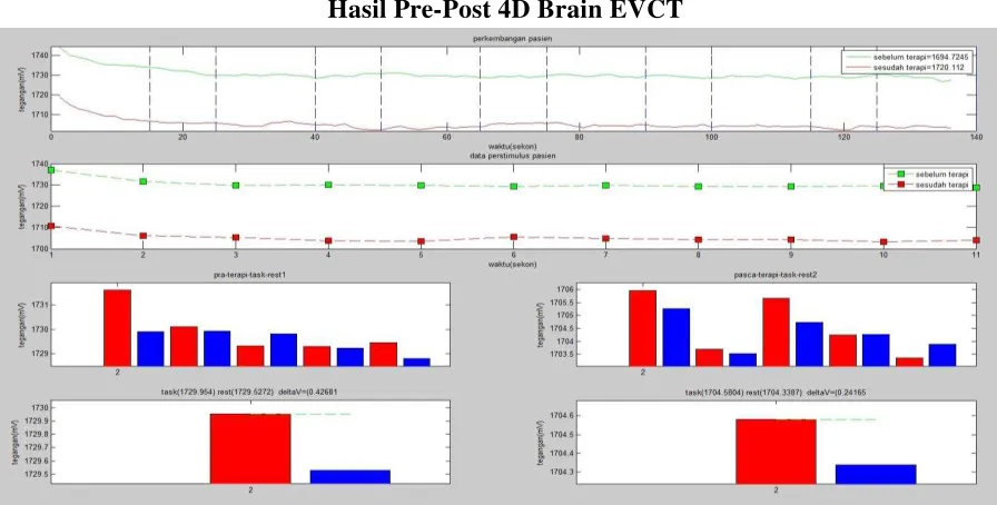 Tabel merah menunjukkan aktivitas otak di fase taskingpenurunan respon otak terhadap stimulus yang disajikan
