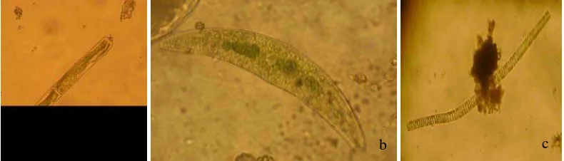 Gambar 3. Divisi Bacillariophyta (a) Bacillaria sp; (b) Eunotia sp; (c) Synedra sp;  (d) Cyclotella sp 