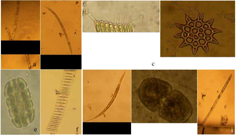 Gambar 5. Divisi Chlorophyta (a) Stigeoclonium sp; (b) Characium sp; (c) Scenedesmus sp; (d) Pediastrum sp; (e) Pandorina sp; (f) Ulothrix sp; (g) Closteriopsis sp; (h) Cosmariunm sp; (i) Gonatozygon sp