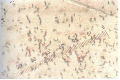 Gambar 1 : Hasil isolasi Bakteri Alcaligenes sp 