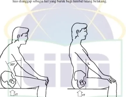Gambar 2.17 Dalam duduk santai (kiri) panggul berputar ke belakang dan tulang 