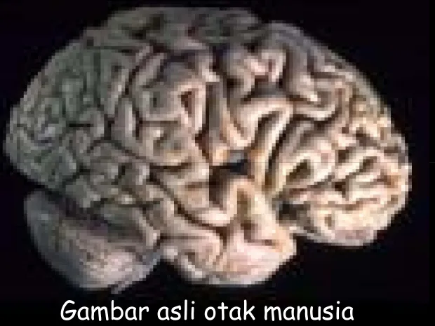 Gambar asli otak manusia
