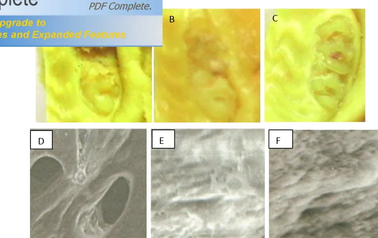 Gambar 1. Pengamatan maturasi gigi secara makroskopis dan mikroskopis (SEM) (pembesaran 1500x) 