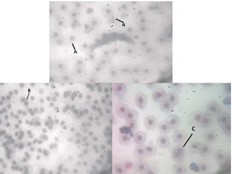 Figure 2. The micrographs (a) Micronucleus (MN), (b) Blebbed (BL), (c) Binucleated (BN)  