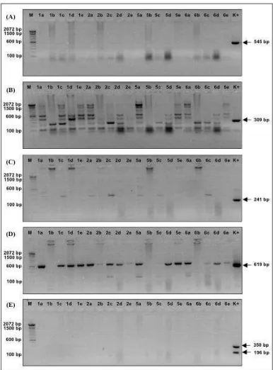 Figure 1.  Identification of virus in laying chicken with stunting symptom by PCR and RT-PCR test