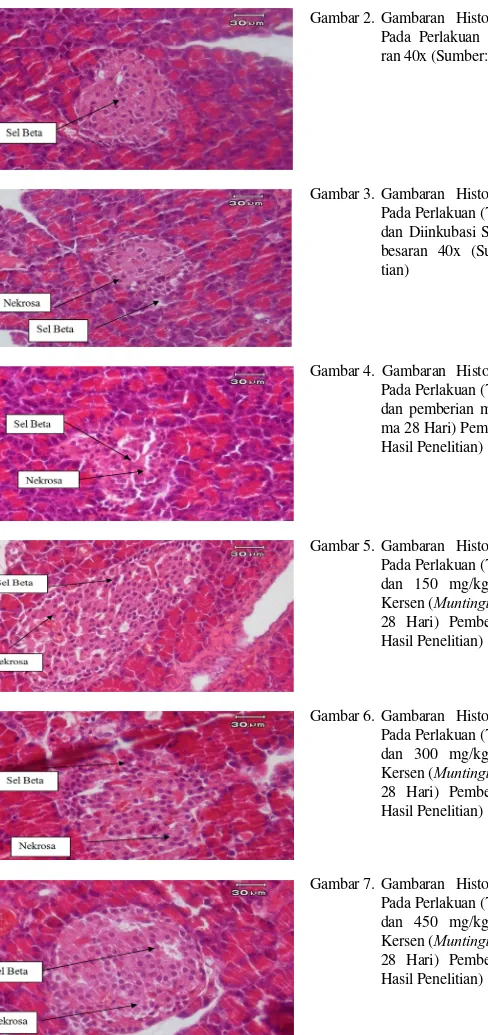 Gambar 7. Gambaran Histologi Pankreas Tikus Pada Perlakuan (75 mg/kg BB Aloksan dan 450 mg/kg BB Ekstrak Daun Kersen (Muntingia calabura.L) Selama 28 Hari) Pembesaran 40x (Sumber: Hasil Penelitian) 