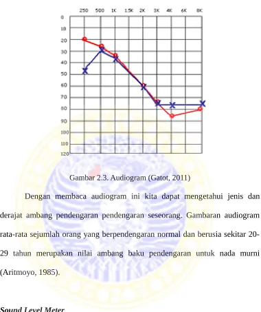 Gambar 2.3. Audiogram (Gatot, 2011)