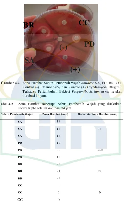 Gambar 4.2  Zona Hambat Sabun Pembersih Wajah antiacne SA, PD, BR, CC, 