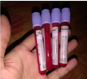 Gambar 10. Eritrosit Kambing 