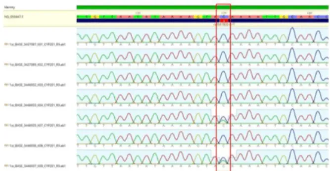 Figure  1:  Alignment  of  sequencing  results  of  NPC  case  group,  samples;  K01,  K02,  K03,  K04,  K07,  K08  and  K09  with  reference  genes CYP2E1 