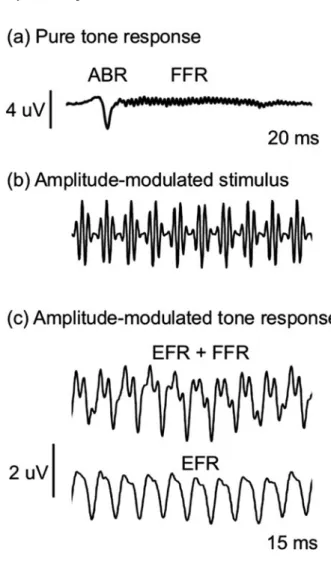 Fig. 2.1 Examples of auditory evoked potentials (AEPs). (a) An AEP recorded in response to a 3-kHz pure tone with 3-ms onset and offset ramps