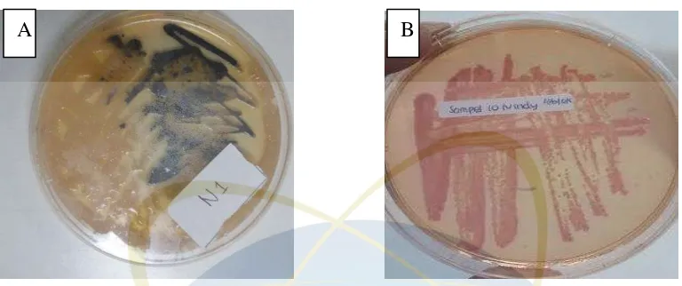 Gambar 4. 1 (A) Pertumbuhan Salmonella sp.terlihat koloni bewarna merah muda yang tidak mencerminkan pertumbuhan  pada media SSA terlihat koloni colorless with black center yang mencerminkan bahwa terdapat bakteri Salmonella sp