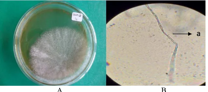Gambar 9. Biakan fungi klon 45 pada media PDA (A) & (B), Phaeophleospora sp. (C), konidia bersepta (a)  