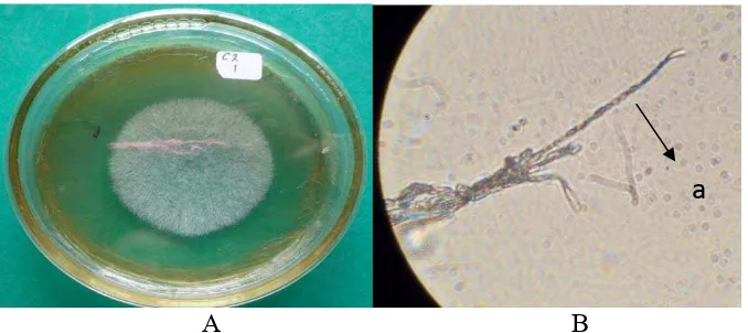 Gambar 11. Biakan fungi klon 46 pada media PDA (A), Cylindrocladium sp. (B),  klamidospora (a)  