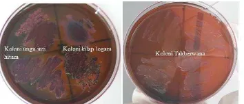 Gambar 4.3. Hasil Gram LB tampak dengan mikroskop pembesaran 100x. 