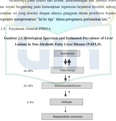 Gambar 2.5 Histological Spectrum and Estimated Prevalence of Liver 