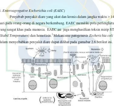 Gambar 2.6 Patogenesis Escherichia coli  