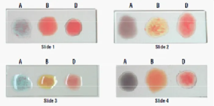 Gambar 3. 3 Contoh hasil pemeriksaan golongan darah dengan metode slide test  (Himedia, 2015).