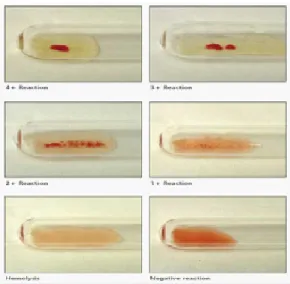 Gambar 3.6 Derajat aglutinasi pada pemeriksaan golongan darah dengan metode  tube test (NIB, 2013).
