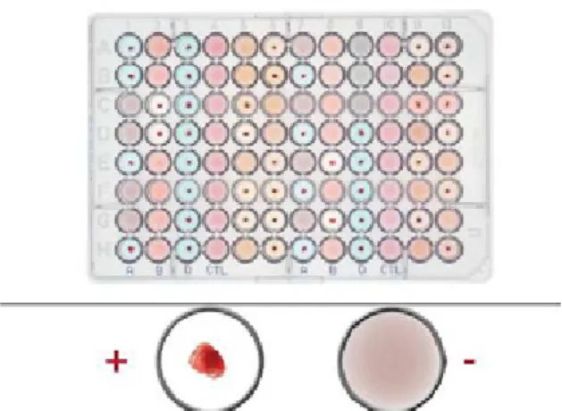 Gambar 3.9 Pola reaksi pada pemeriksaan golongan darah dengan microplate test  (Diagast, 2016).