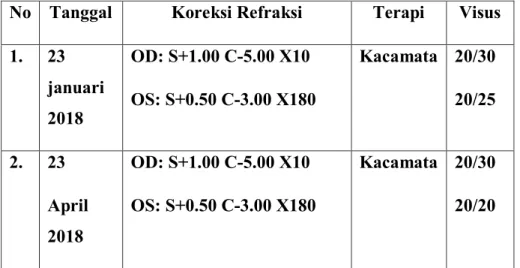 Tabel 4.2 Perkembangan Visual Astigmat Mixtus  No  Tanggal  Koreksi Refraksi  Terapi  Visus  1