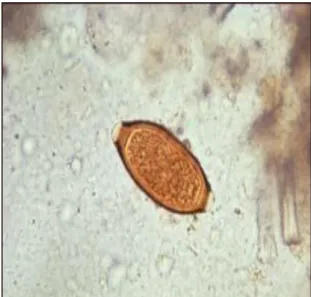 Gambar 5. Telur T.trichiura (Sumber : CDC, 2013). 