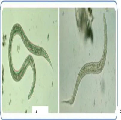 Gambar 7. a. Cacing A.duodenale b. cacing A.Americanus (Sumber : CDC,  2013).  