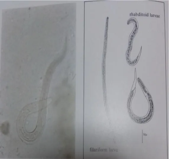 Gambar 9. Larva rhabditiform dan Filariform S.strecoralis  ( Sumber :  Suzuki, 1975). 