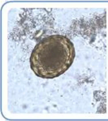 Gambar 2. Telur A. lumbricoides (Sumber : CDC, 2018) 