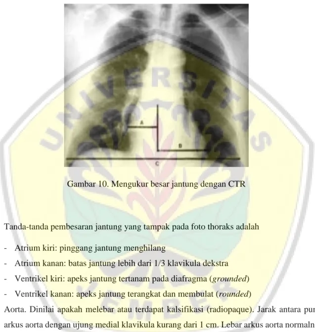 Gambar 10. Mengukur besar jantung dengan CTR 