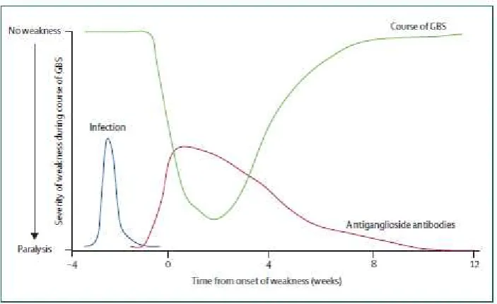 Gambar 1. Perjalanan Klinis GBS 