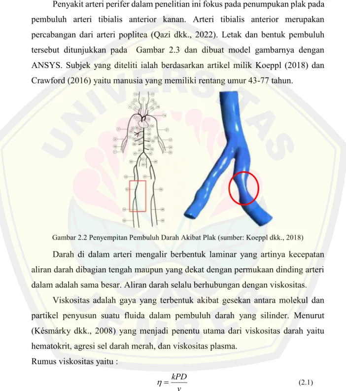 Analisis Numerik Penyempitan Pembuluh Darah Akibat Penyakit Arteri