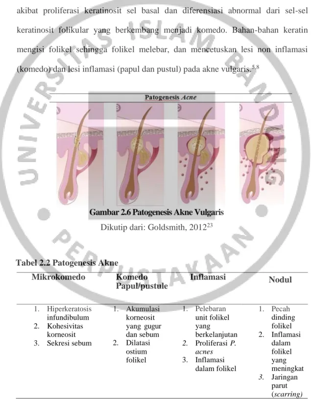 Gambar 2.6 Patogenesis Akne Vulgaris  Dikutip dari: Goldsmith, 2012 23