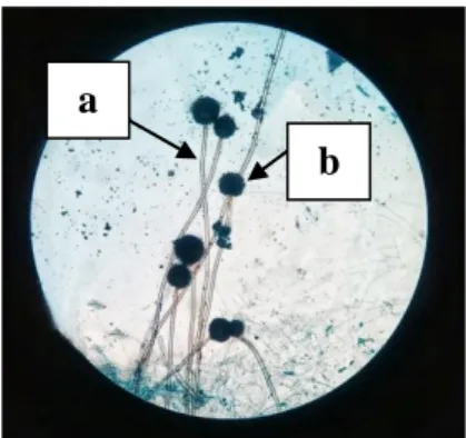 Gambar 5. Makroskopis jamur  Aspergillus sp. 