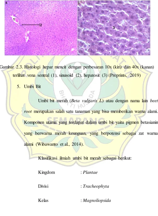 Gambar  2.3. Histologi  hepar  mencit  dengan  perbesaran  10x (kiri)  dan 40x (kanan)  terlihat  vena  sentral  (1), sinusoid  (2), hepatosit  (3) (Preprints,  2019) 