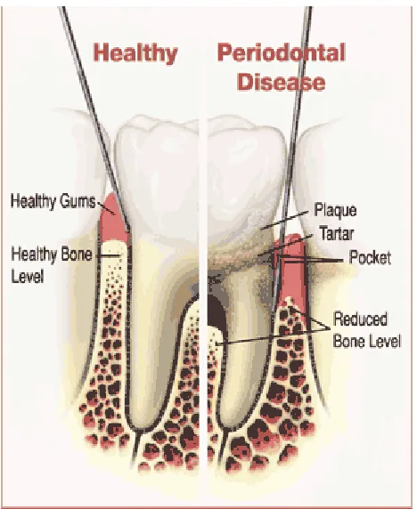 Gambar anatomi gigi 